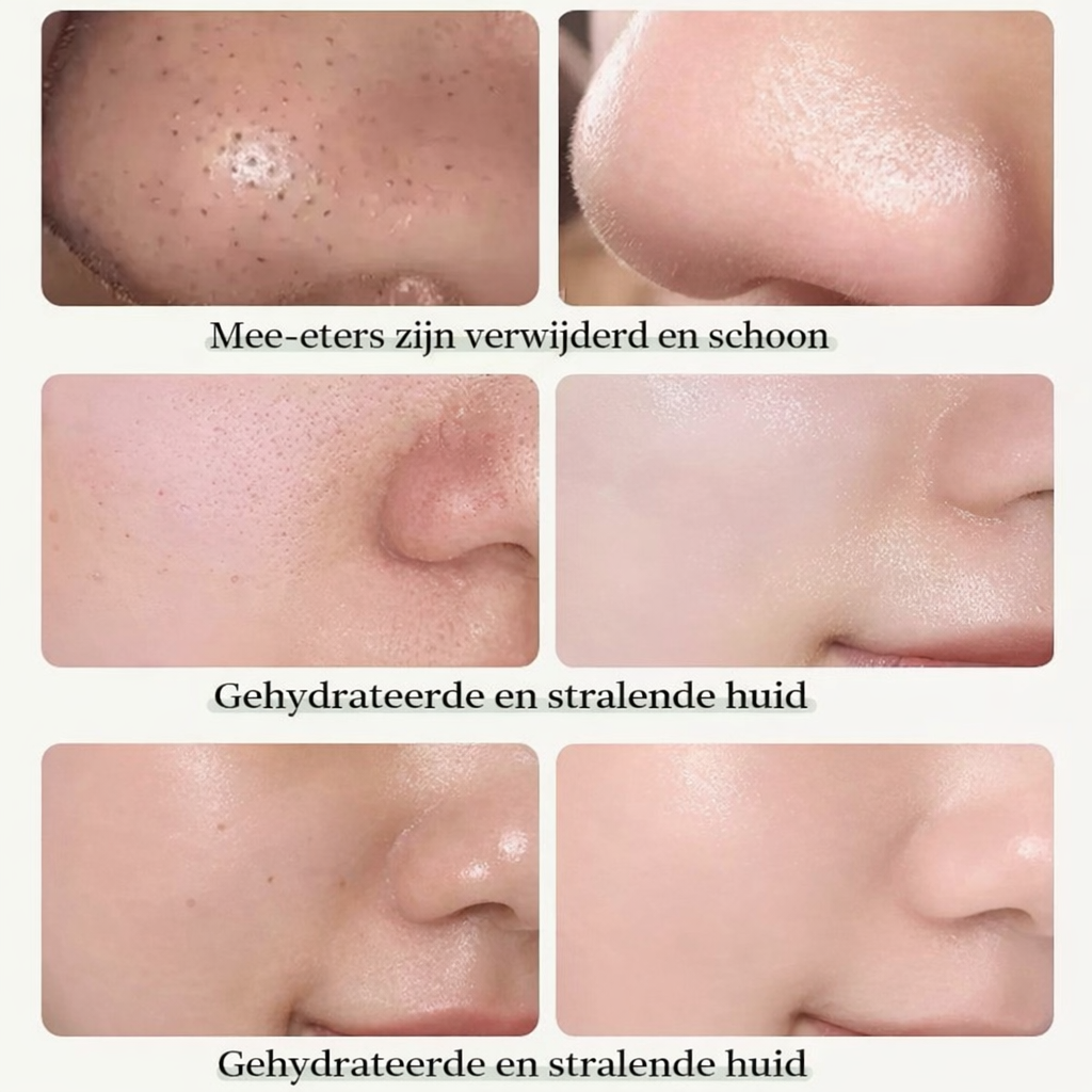 Green Tea Mask Stick | Tegen Acne & Mee-eters | Diepe Reiniging